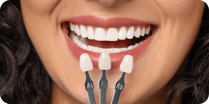 Cosmetic dental procedures to improve the look of your teeth