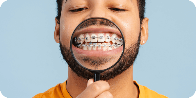A man holding a magnifying glass showcasing his teeth and braces