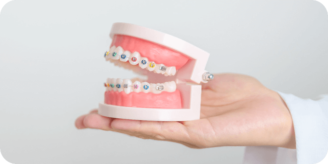 A model of a jaw wearing colourful braces. 