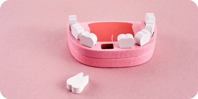 A diorama of missing teeth, that may require a dental implant to fix.