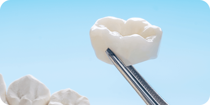 A same-day dental crown used by dentists to fit over damaged teeth in a day.